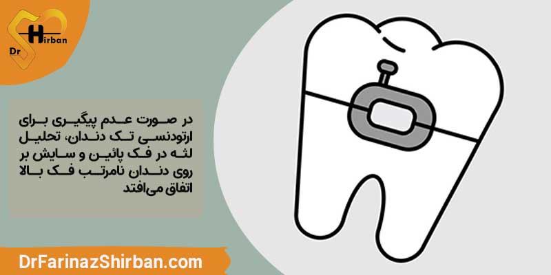 اهمیت ارتودنسی تک دندان