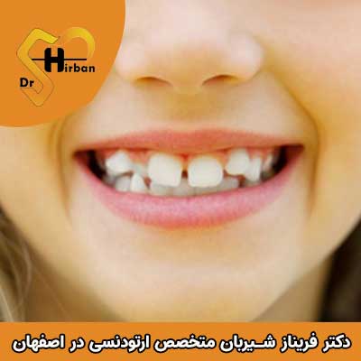 علت و درمان دندان کج کودکان