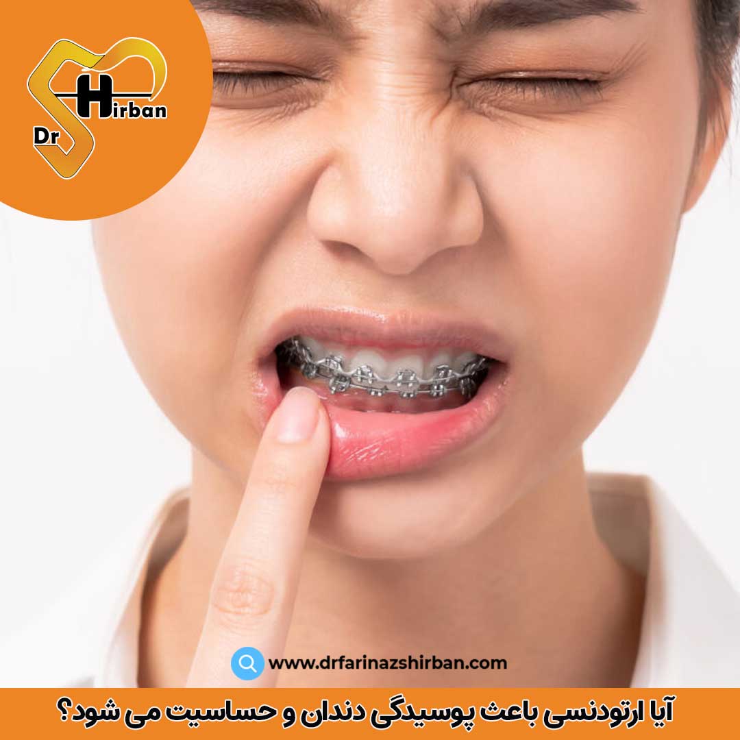 آیا ارتودنسی باعث پوسیدگی دندان و حساسیت می شود؟