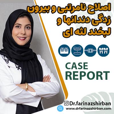 اصلاح نامرتبی و بیرون زدگی دندانها و لبخند لثه ای توسط دکتر فریناز شیربان متخصص ارتودنسی در اصفهان
