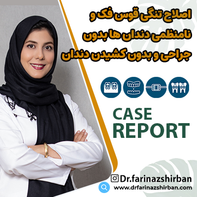 اصلاح تنگی قوس فک و نامنظمی دندان ها بدون جراحی و کشیدن دندان با دکتر فریناز شیربان متخصص ارتودنسی در اصفهان