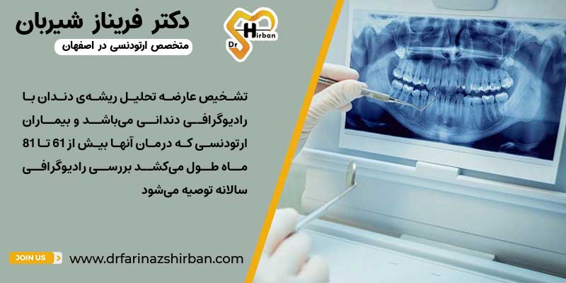 تشخیص تحلیل دندانی با رادیوگرافی توسط متخصص ارتودنسی در اصفهان
