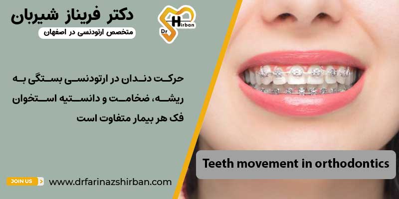 حرکت دندان پس از ارتودنسی در هر بیمار متفاوت است