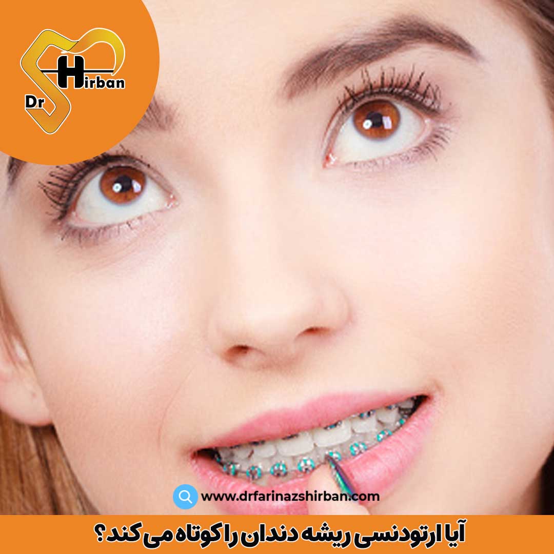 آیا ارتودنسی ریشه دندان را کوتاه می کند؟