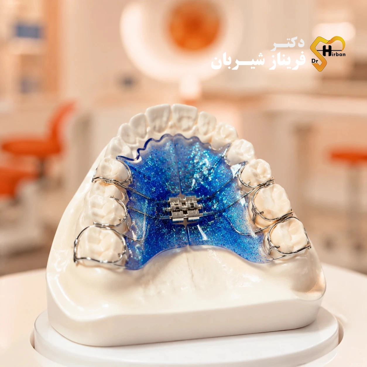 عکس پلاک ارتودنسی متحرک رنگی در دهان کودک