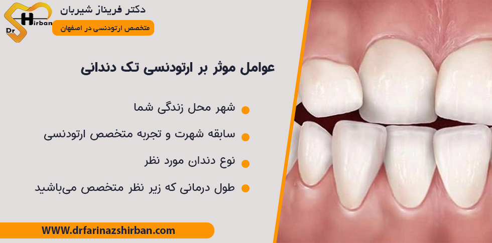 عوامل موثر بر هزینه ارتودنسی تک دندان در اصفهان