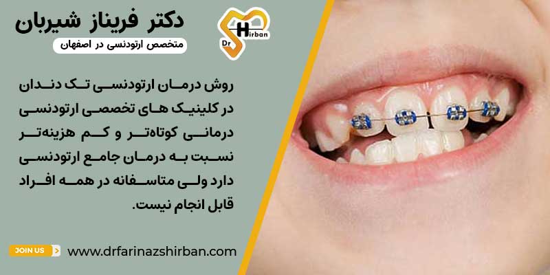 ارتودنسی تک دندانی در بهترین کلینیک تخصصی ارتودنسی در اصفهان