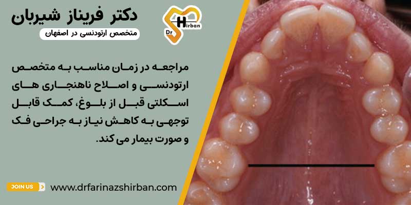 بهترین زمان معاینه ناهنجاری تنگی قوس فکی چه سنی است؟