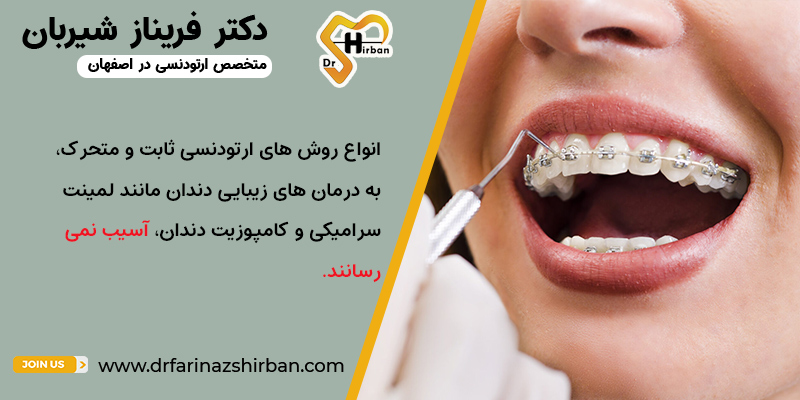 ارتودنسی روی لمینت سرامیکی و کامپوزیت دندان | مطب ارتودنسی دکتر فریناز شیربان در اصفهان