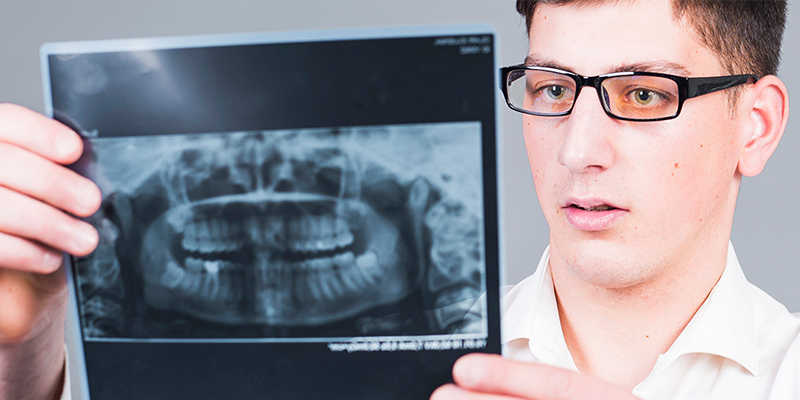 عکس دندان قبل از جراحی فک | دکتر فریناز شیربان در اصفهان