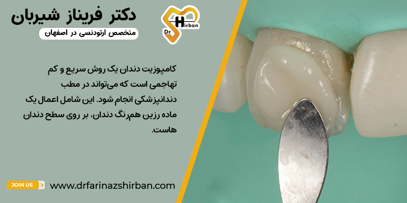 کامپوزیت دندان چیست؟ | مطب دکتر فریناز شیربان