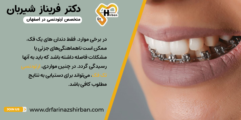 چرا ارتودنسی تک فک انجام دهیم؟ پ مطب ارتودنسی دکتر فریناز شیربان در اصفهان