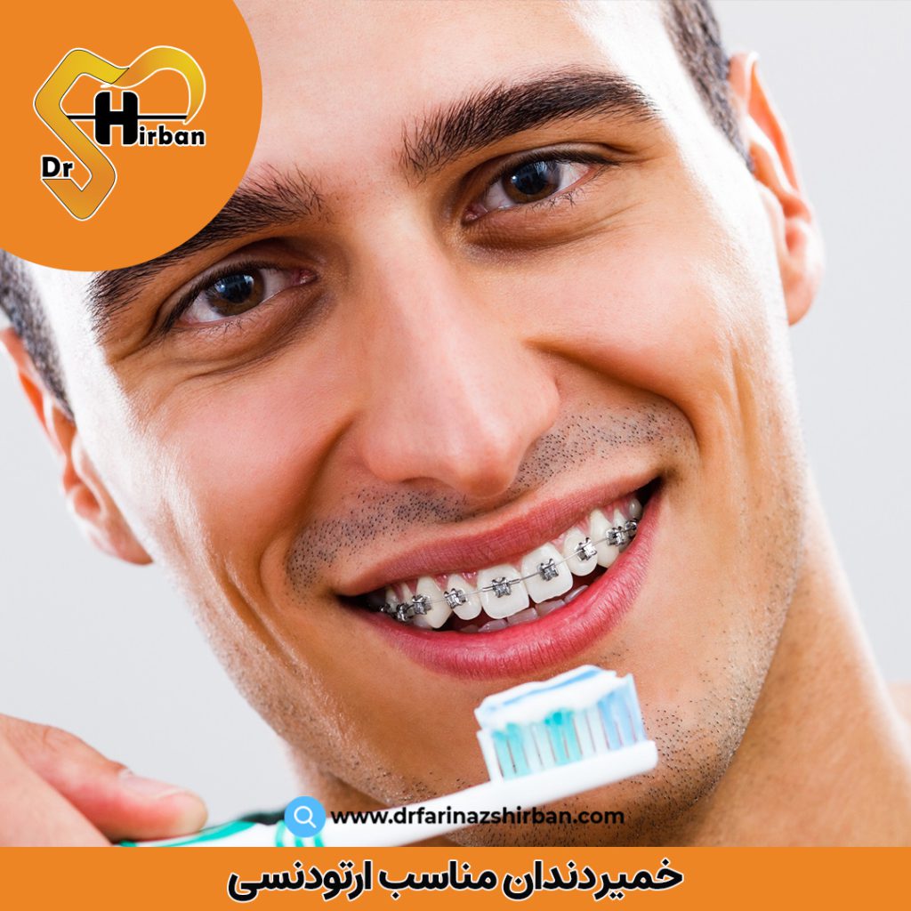 خمیر دندان مناسب ارتودنسی | دکتر فریناز شیربان