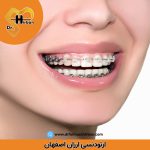 ارتودنسی ارزان اصفهان | دکتر فریناز شیربان