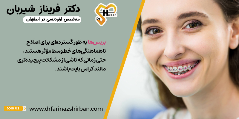 4 روش برتر برای اصلاح ناهماهنگی خط وسط در بزرگسالان | دکتر فریناز شیربان