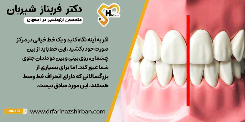 انحراف خط وسط(میدلاین) چیست؟ | دکتر فریناز شیربان