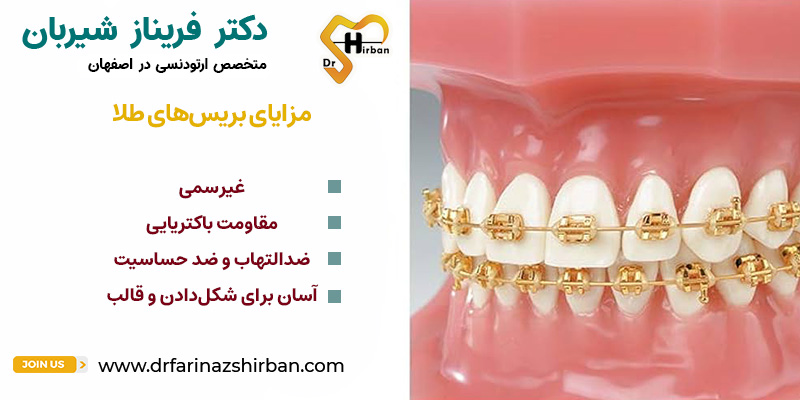 مزایای بریس‌های طلا | بهترین مطب ارتودنسی اصفهان