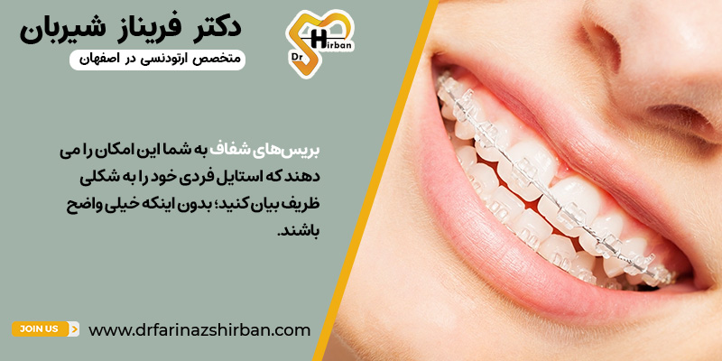 رنگ‌های بریس تقریباً نامرئی | دکتر فریناز شیربان