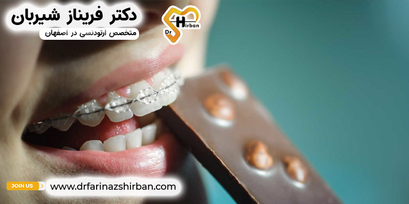 غذا و نوشیدنی‌هایی که نباید با بریس‌های رنگی مصرف کنید | مطب دکتر شیربان در اصفهان