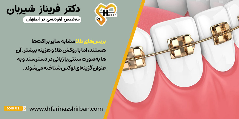 بریس‌های طلا چیست؟ | دکتر فریناز شیربان