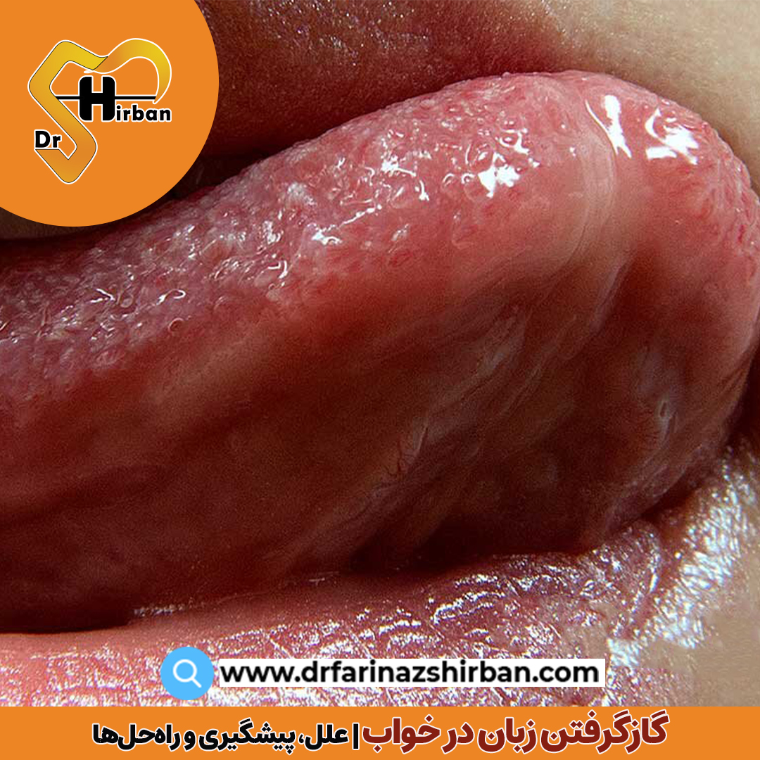 گازگرفتن زبان در خواب: علل، پیشگیری و راه‌حل‌ها | دکتر فریناز شیربان
