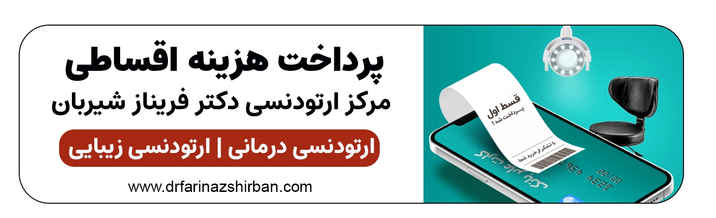 پرداخت هزینه ارتودنسی اقساطی در اصفهان