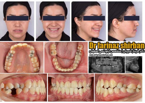 أخصائي تقويم الأسنان في أصفهان | د.فاريناز شيربان