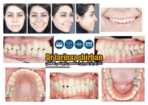 أخصائي تقويم الأسنان في أصفهان | دكتور. فاريناز شيربان